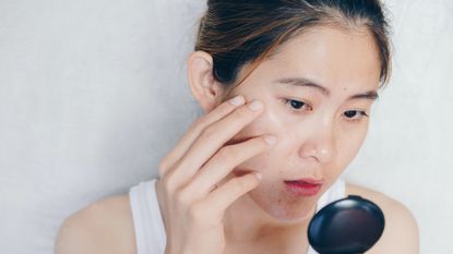 woman looking at acne in handheld mirror