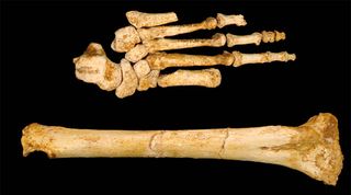 foot bones of Homo floresiensis.