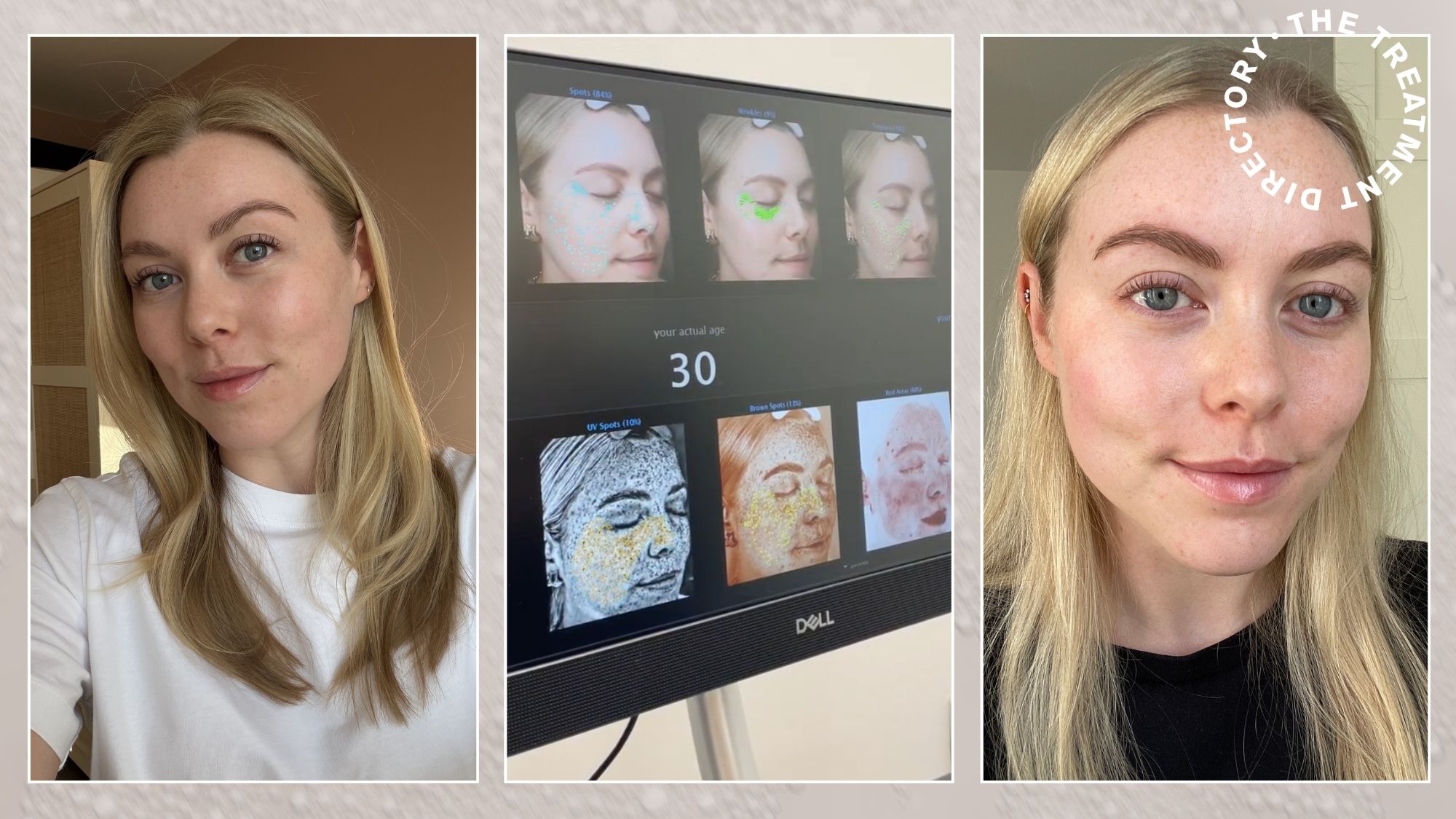 Florrie Alexander before and after Julaine