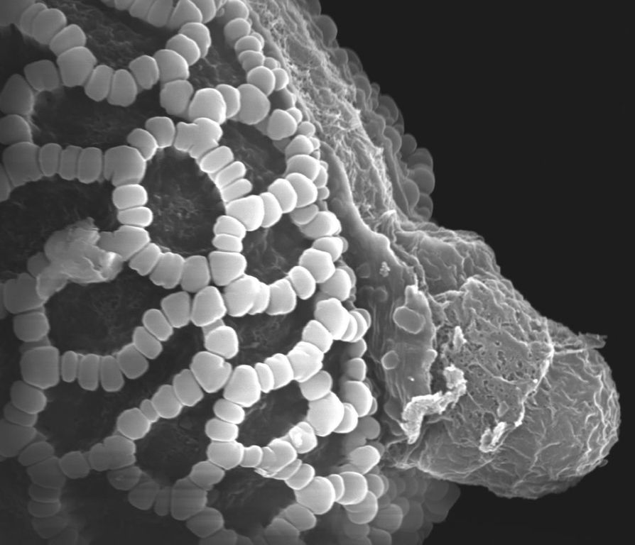 Lily pollen grains