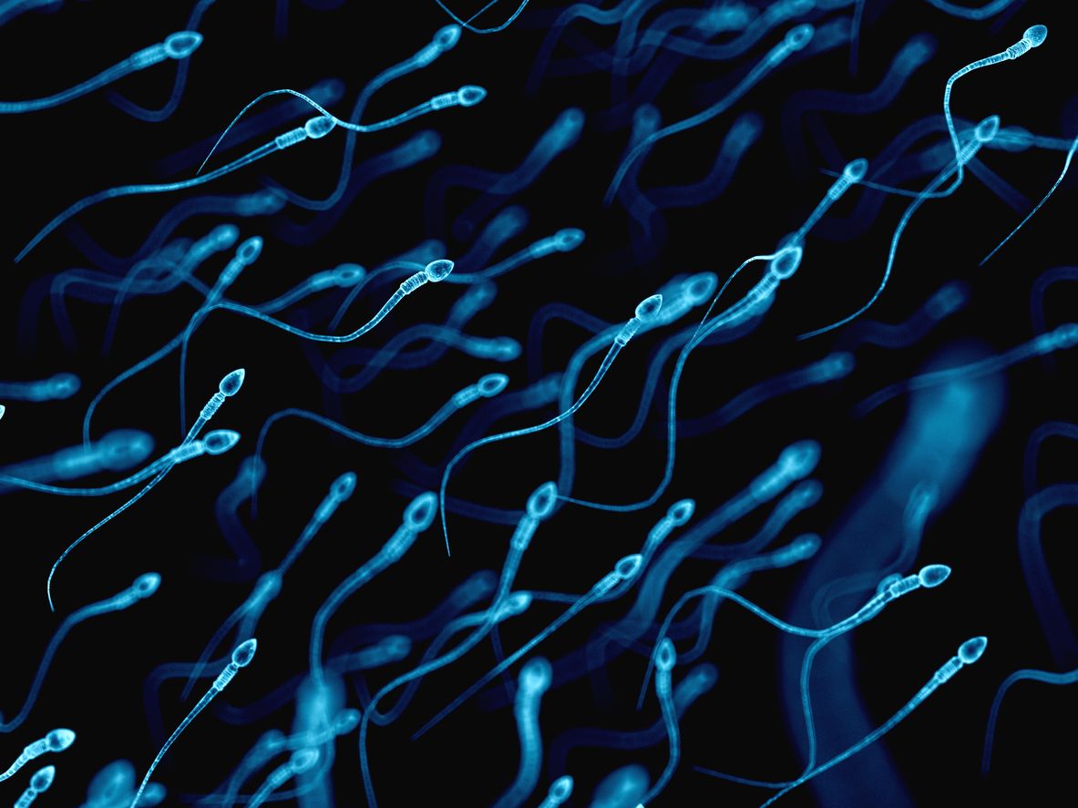 Sperm.