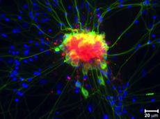 research in action, ria, National Institutes of Health, NIH, anti-inflammatory drugs, NSAIDs, pain relievers, avoiding side effects, next generation pain relievers, 
