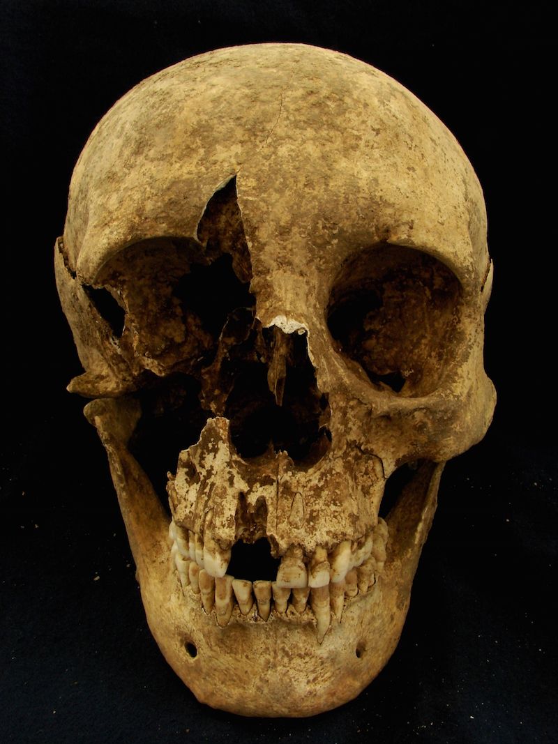 The skull of a middle-age man who was probably a migrant to Rome during the Imperial era. 