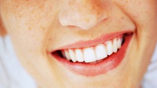 Are teeth considered bones? image shows smile