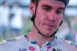 Dutch Fabio Jakobsen of Soudal QuickStep has a cut on his cheek after being accidentally hit in the face with the smartphone of a fan at the finish of stage 7 the final stage of the Vuelta a San Juan cycling tour with start and finish at the Avenida Circunvalacion y Mendoza Sur 1127 km in San Juan Argentina Sunday 29 January 2023BELGA PHOTO SEBASTIAN GIL MIRAN Photo by SEBASTIAN GIL MIRAN BELGA MAG Belga via AFP Photo by SEBASTIAN GIL MIRANBELGA MAGAFP via Getty Images