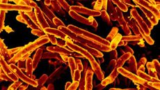 microscopic photo of many rod-shaped bacterial cells stained orange and yellow against a black background