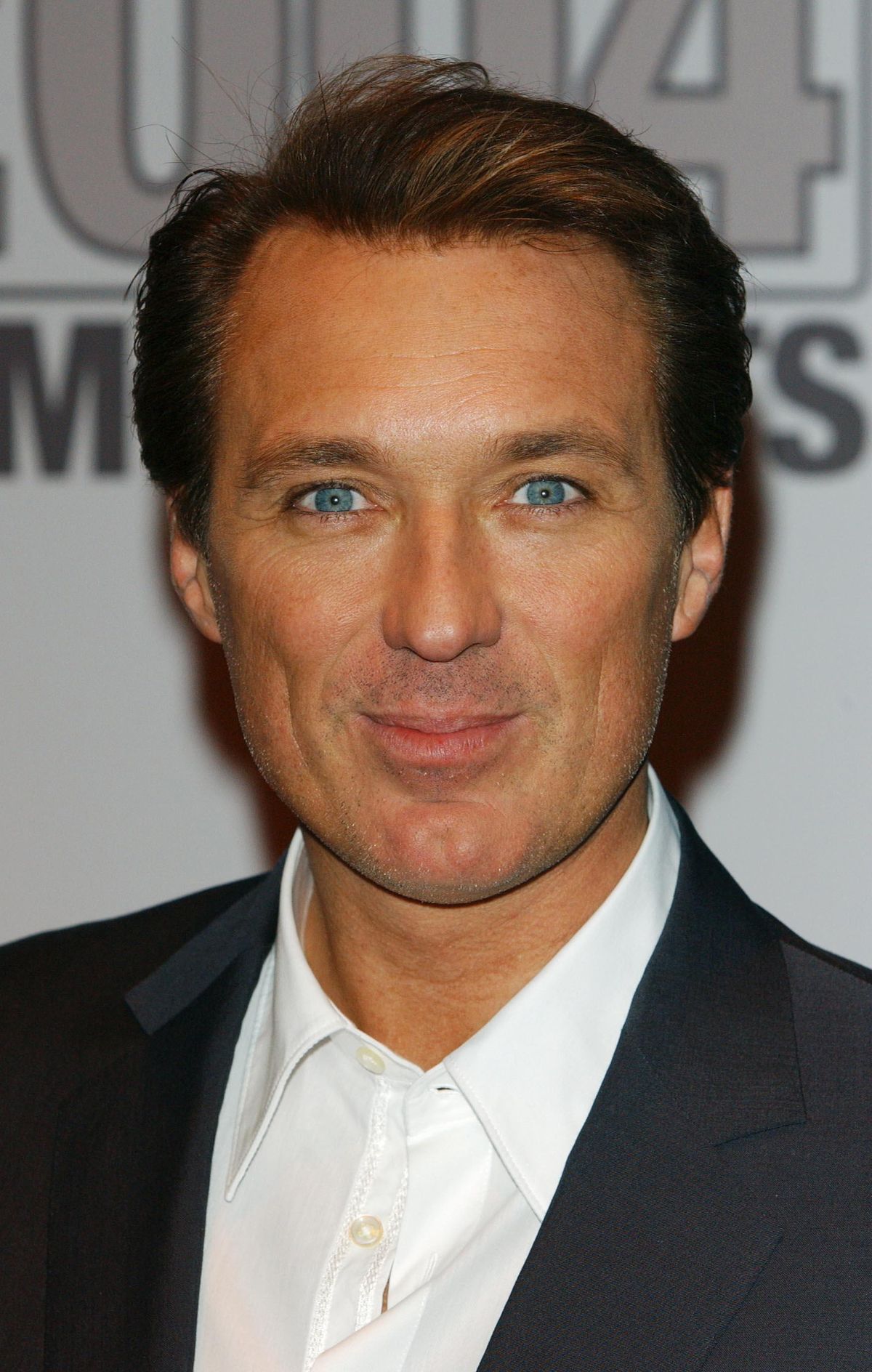 Martin Kemp: I still have epilepsy