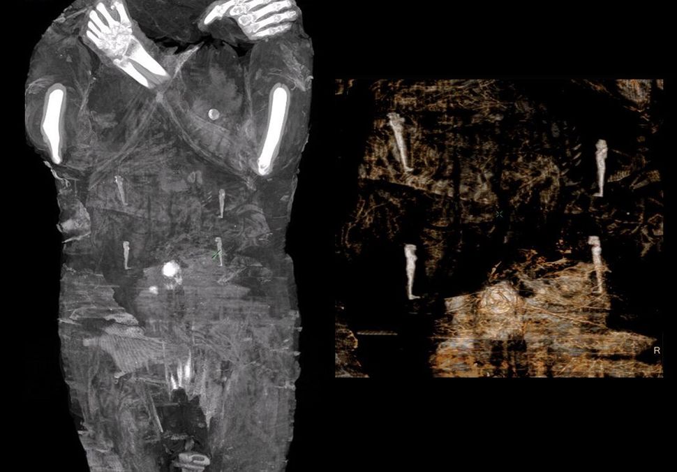 First Known Pregnant Mummy Discovered Live Science 1176