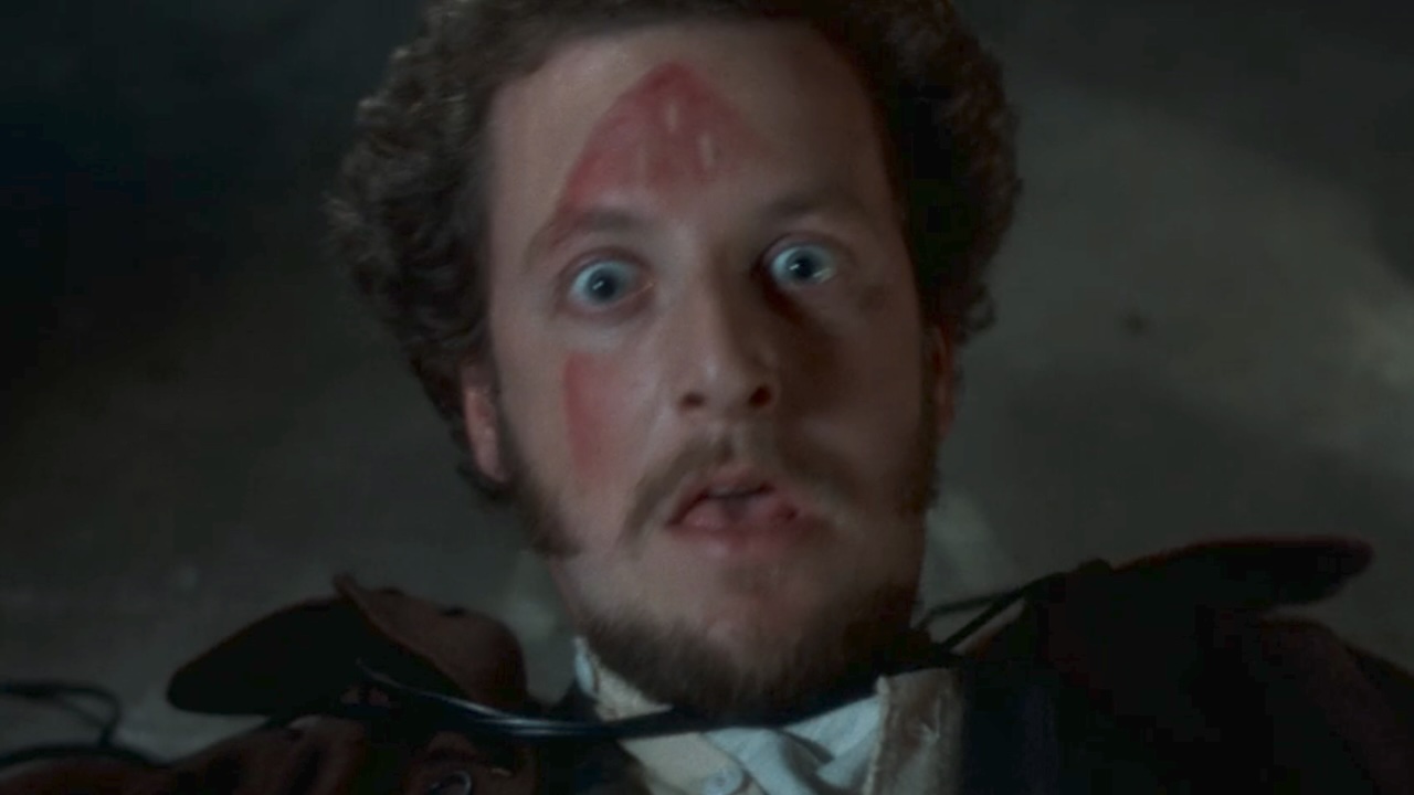 Daniel Stern with an iron burn mark on his face in Home Alone