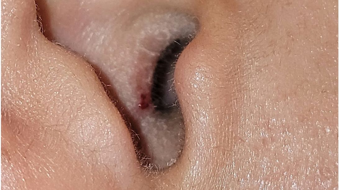 Images of irritation in TheBlack_Swordsman from Samsung Galaxy Buds2 Pro
