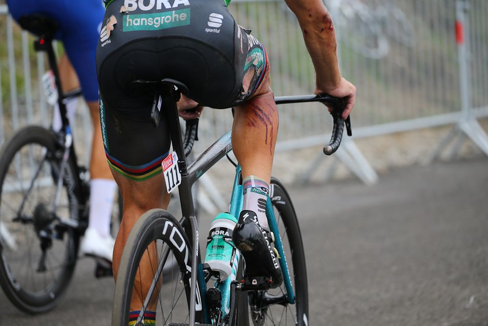 Peter Sagan's kit shows the damage following his stage 17 crash at the Tour de France