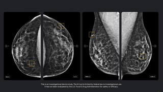Google IO 2021 mammography
