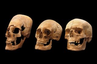 Three human skulls against a black background