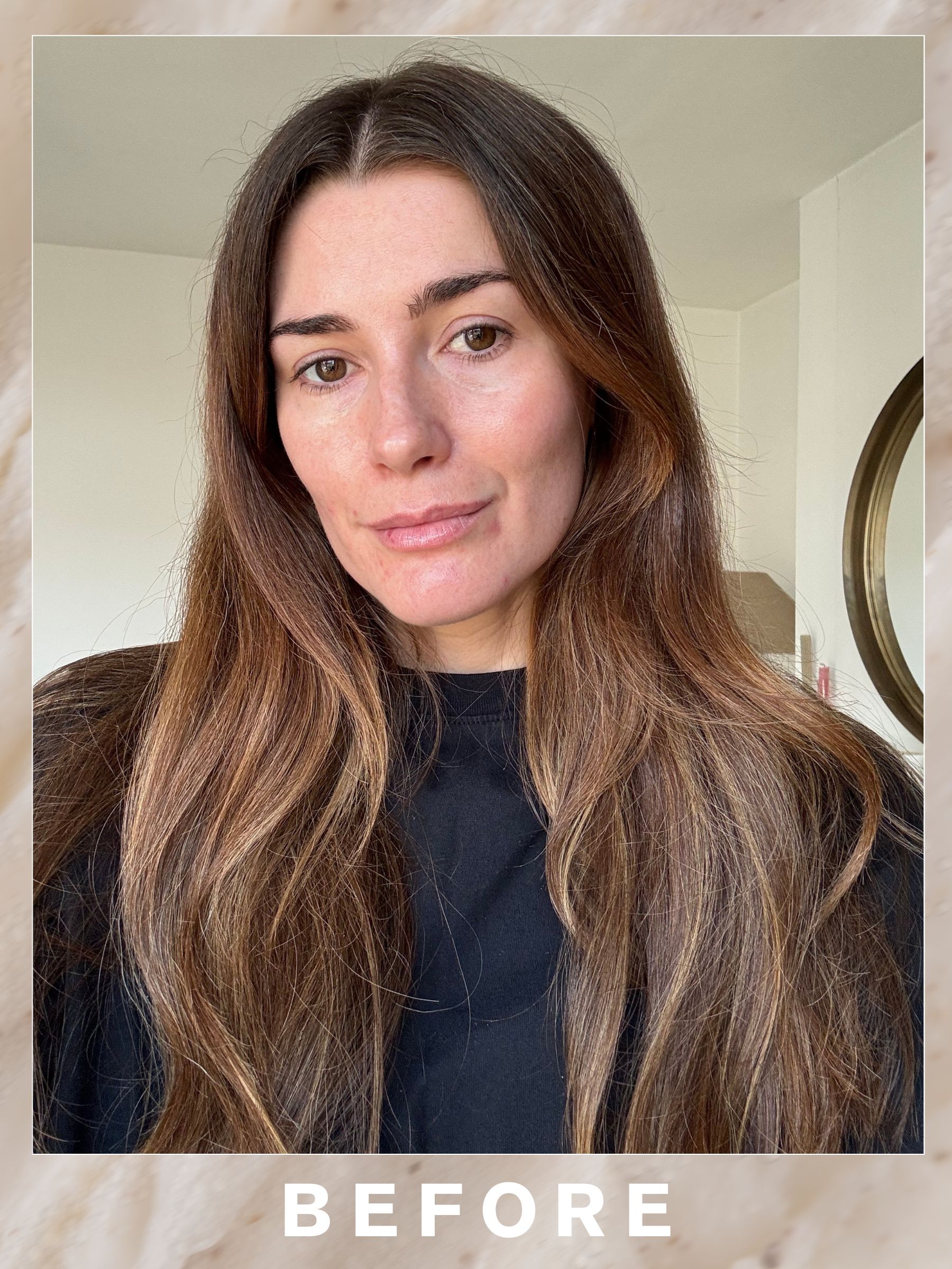 Eleanor's skin before the IS Clinical Flash Brightening Peel