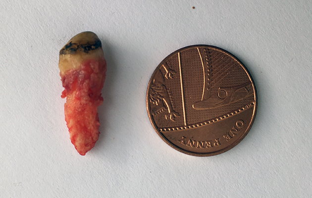 A wolf tooth that has been removed from a horse's gum.
