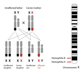 Diagram of the genetics behind hemophilia A and B inheritance.