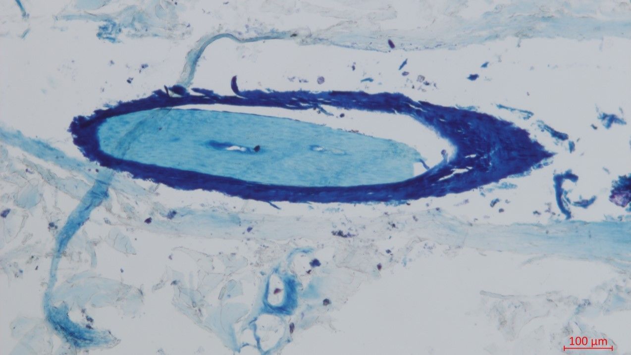 A microscope image showing a blue ring with a line coming out of it