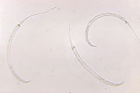 Images: Human Parasites Under the Microscope | Live Science