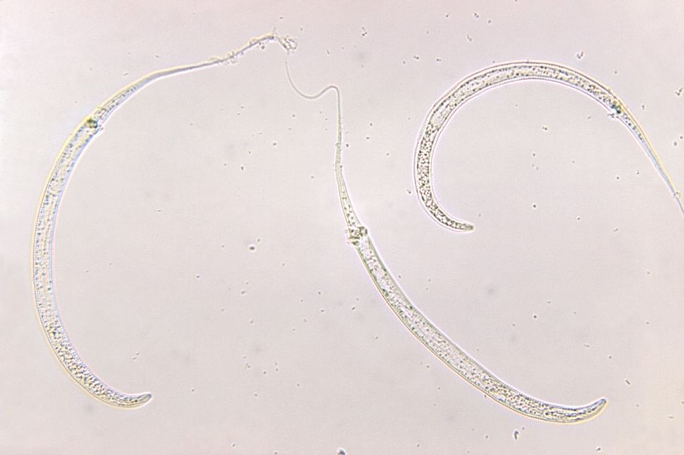 Images Human Parasites Under The Microscope Live Science