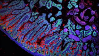 very colorful cells showing the ridges that make up the edge of the small intestine