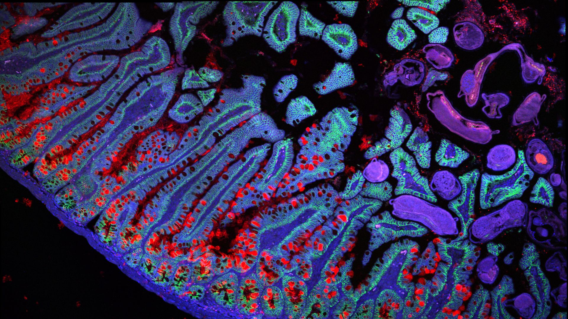 very colorful cells showing the ridges that make up the edge of the small intestine