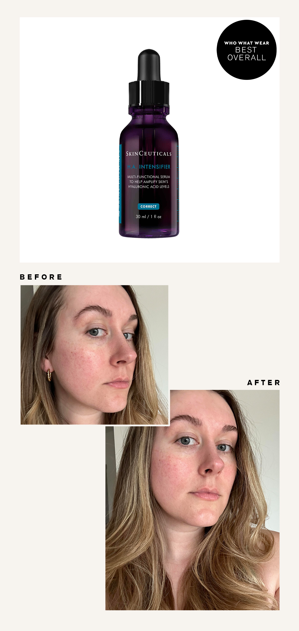 Skinceuticals Hyaluronic Acid: Before and After Picture