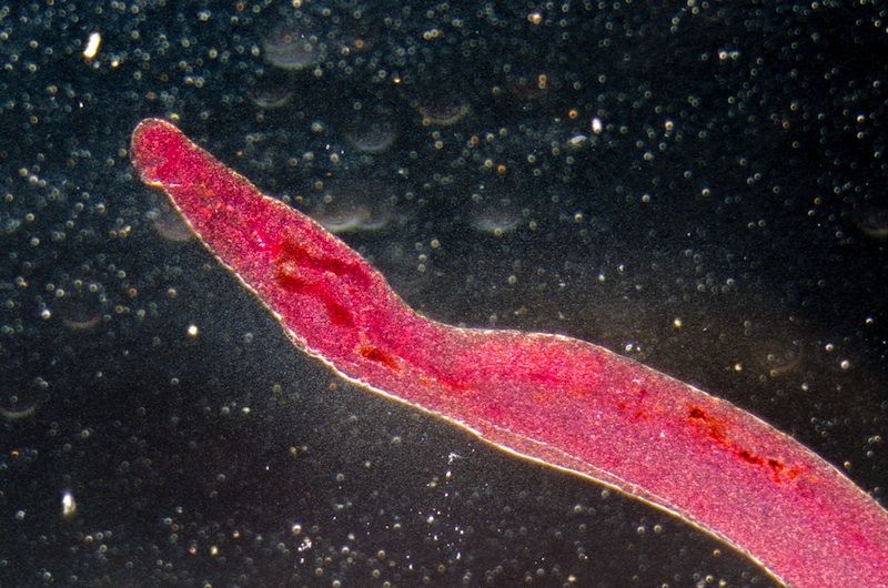 schistosome parasite magnified at 100x