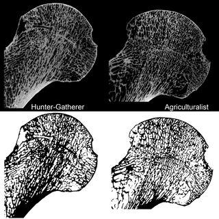 Relatively sedentary human agriculturalists (right) have more lightly built skeletons compared to more mobile foragers (left). Pictured are 2D microCT images through the femoral head at the hip joint showing differences in bone structure.