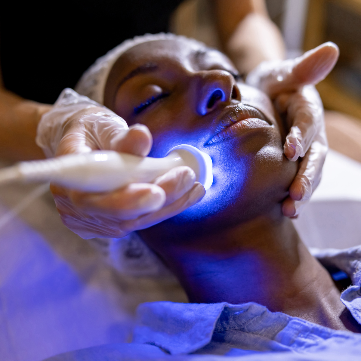 Best lasers for Black skin