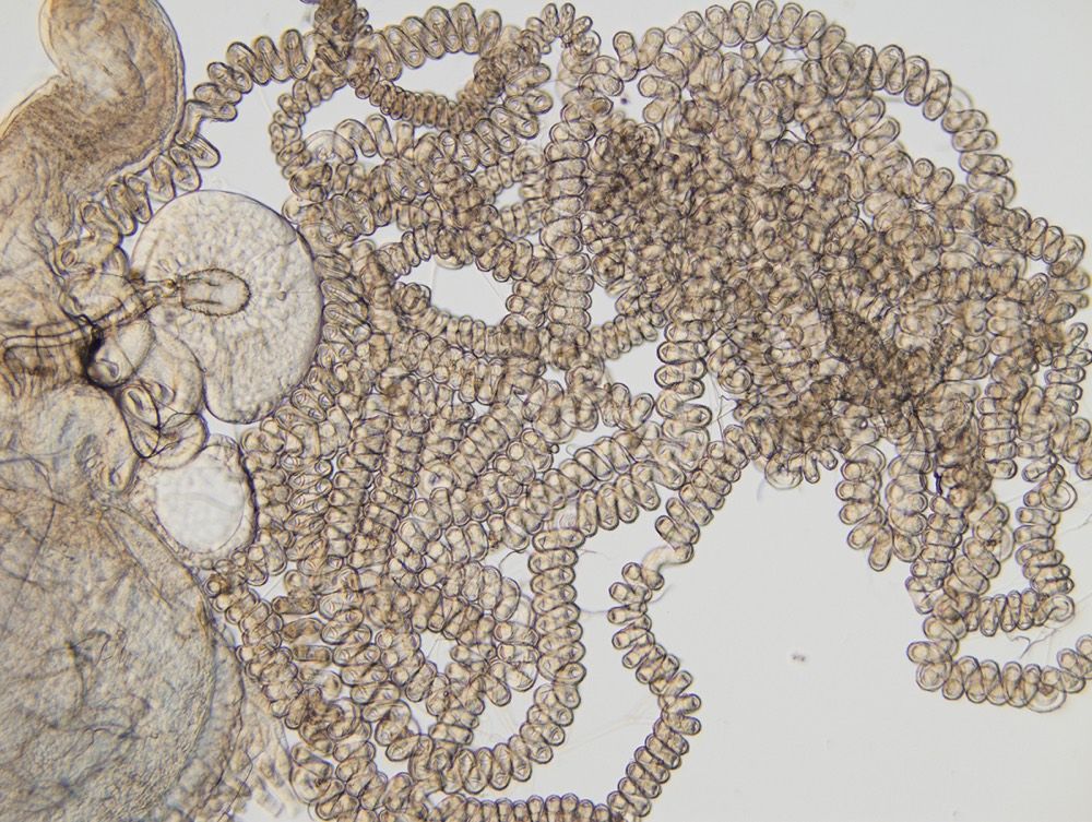 The sperm-storage tubule of the fruit fly &lt;em&gt;Drosophila bifurca&lt;/em&gt; is nearly 8 centimeters long.