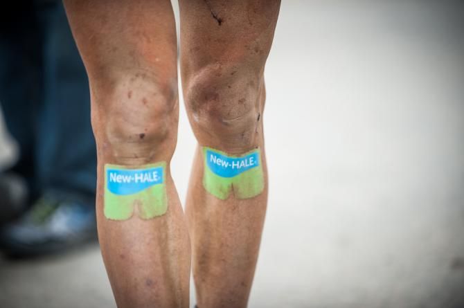 Legs