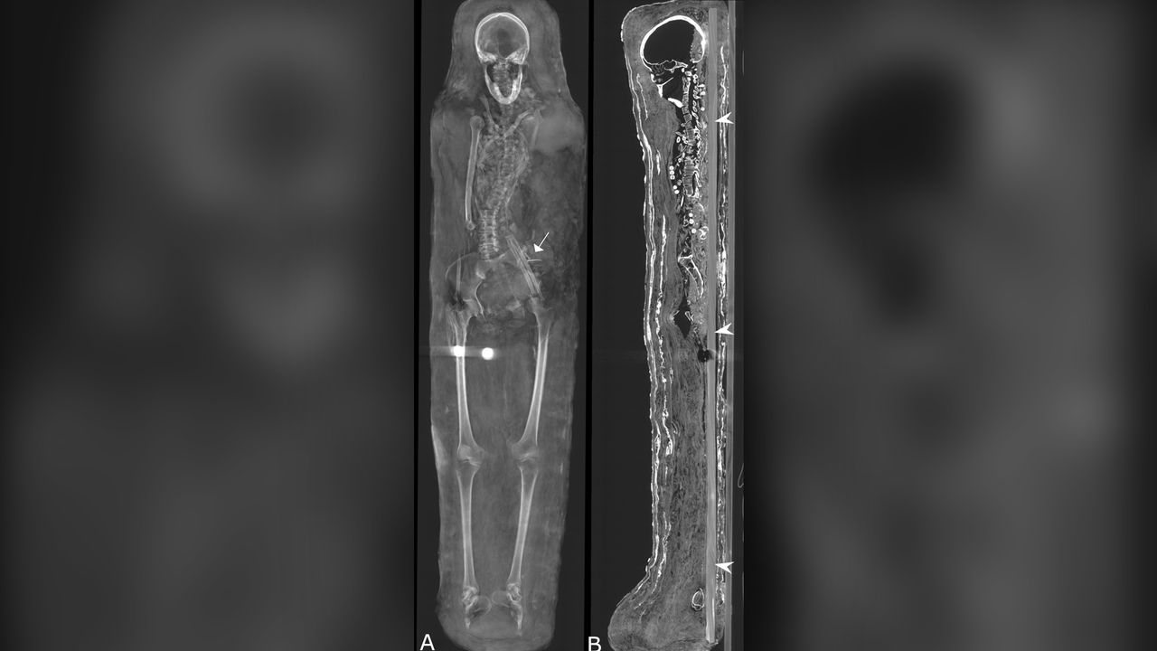 Two circles (A) found in the woman's mummy might be coins or medallions, while two nails (arrow) were located near her stomach. The wooden board (B) behind the woman was intact.