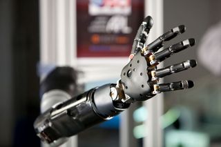mind-controlled prosthetic hand