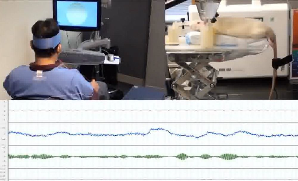 human and rat brains linked in experiment