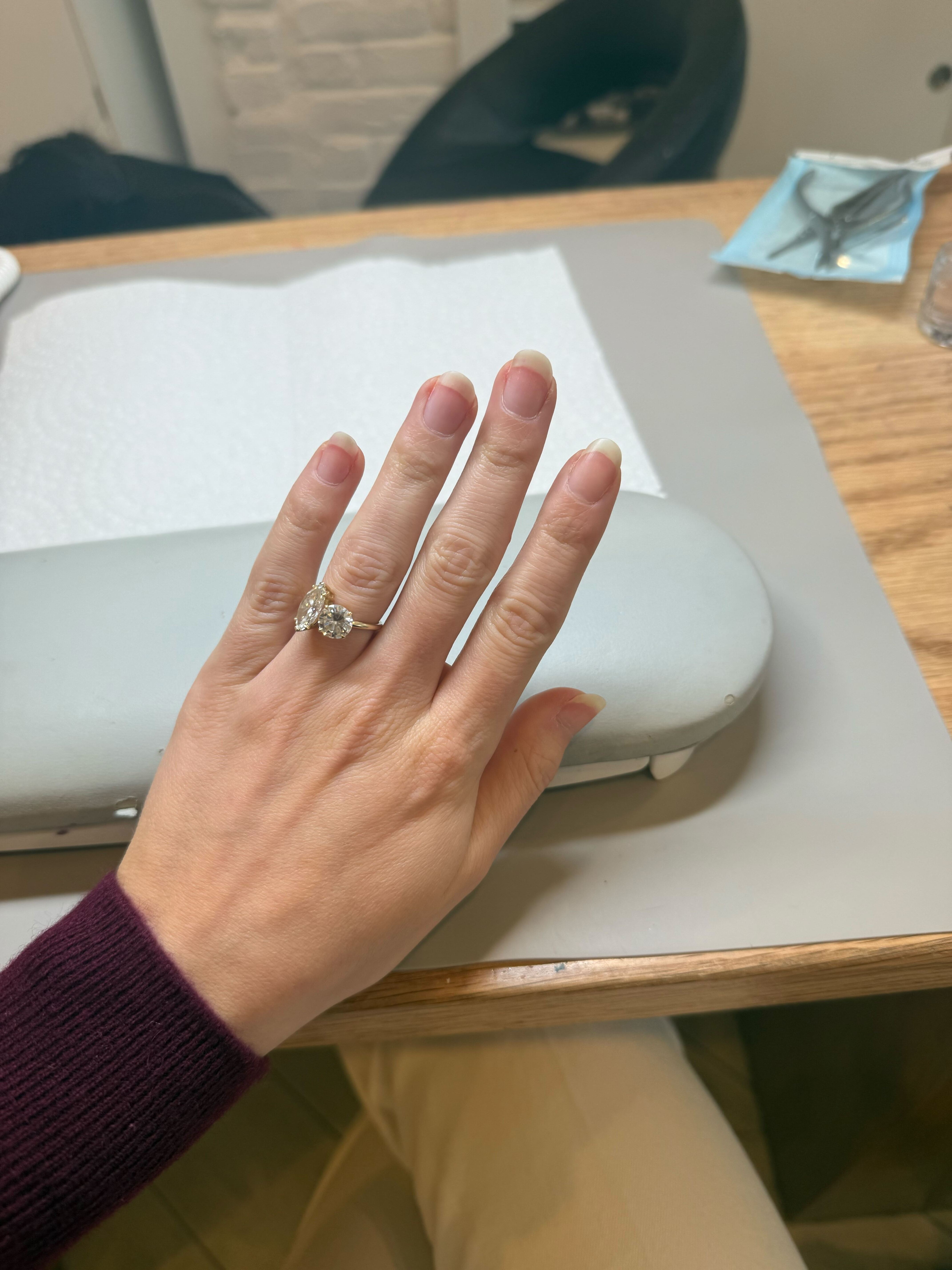 Jamie Schneider's nails before getting Japanese gel manicure