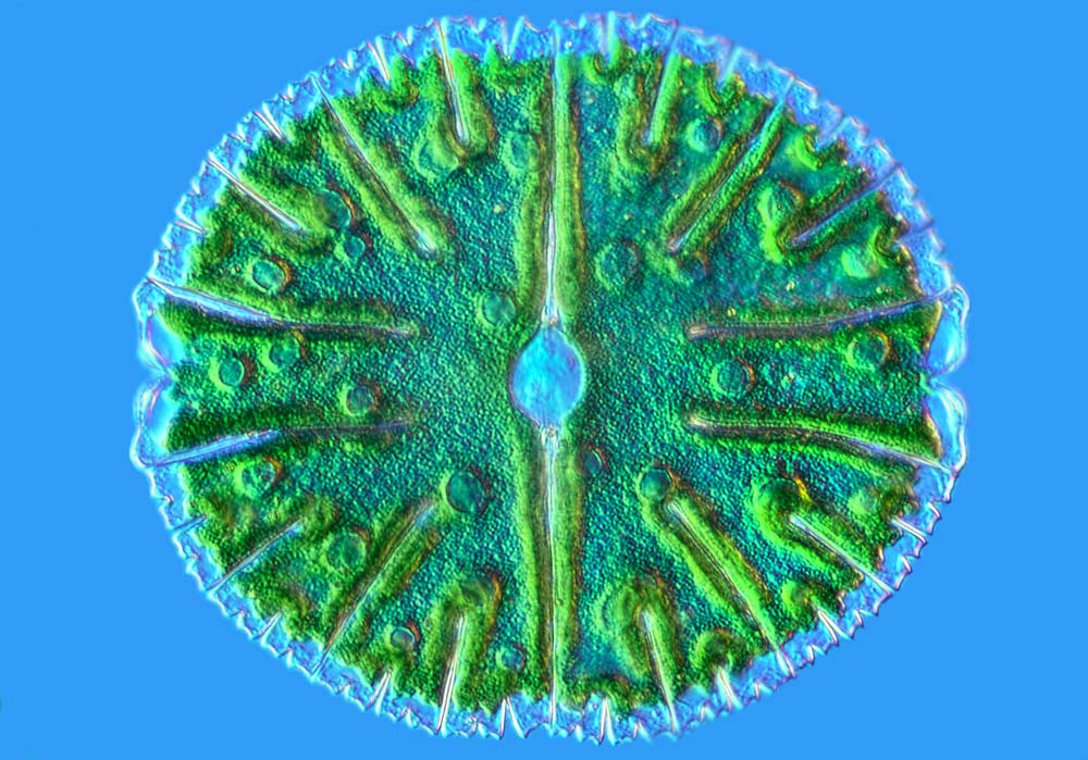 a photo of a type of green alga called a desmid