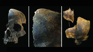 Image of three fragmentary skulls with evidence of fractures that happened around the time of death