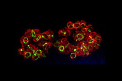 Many antibiotics work by blocking bacteria from making a mesh-like polymer by strengthening cell walls