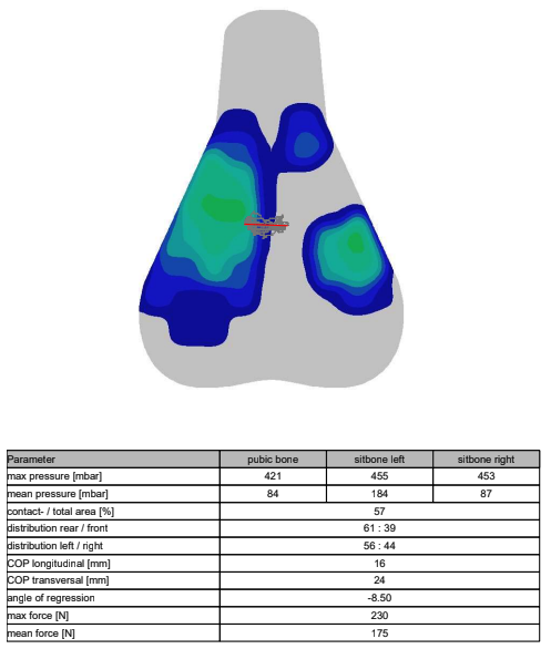 A visual output of saddle pressure mapping