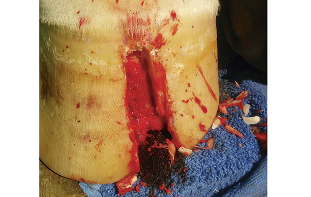 After the keratoma has been removed. The pedal bone visible at the back of the channel