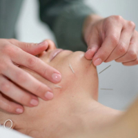 COSMETIC ACUPUNCTURE, FROM £245 FOR 1H 30MINS | HARVEY NICHOLS