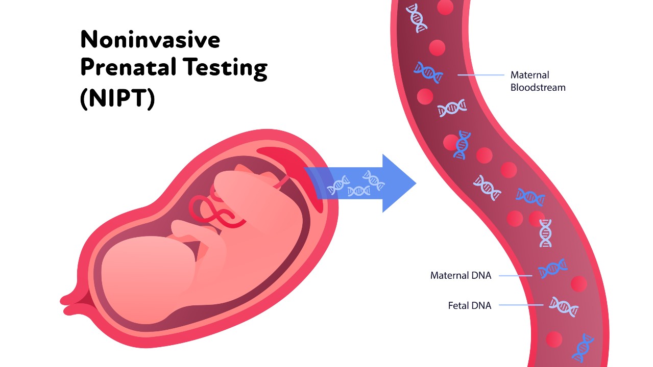 Diagram of NIPT