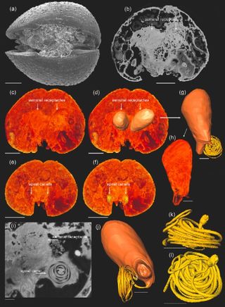 anatomy of a female ostracod