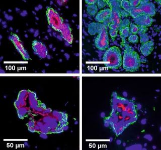 A four paneled image showing clumps of cells in purple, green, and pink colors