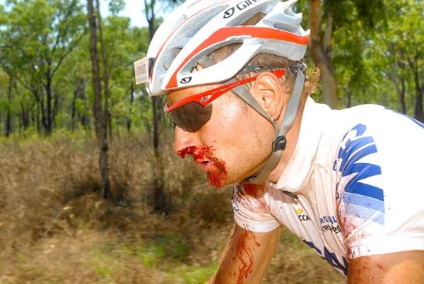 Urs Huber (St&ouml;ckli Pro Team) raced to the finish with a bloody nose