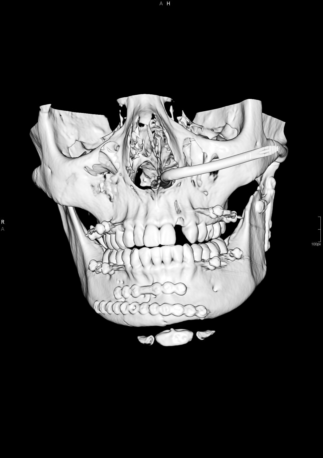 WhiteoutScan-2.jpg