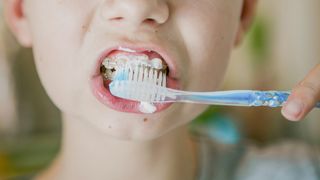 Is fluoride good for your teeth: Image shows boy cleaning teethimage shows boy brushing teeth