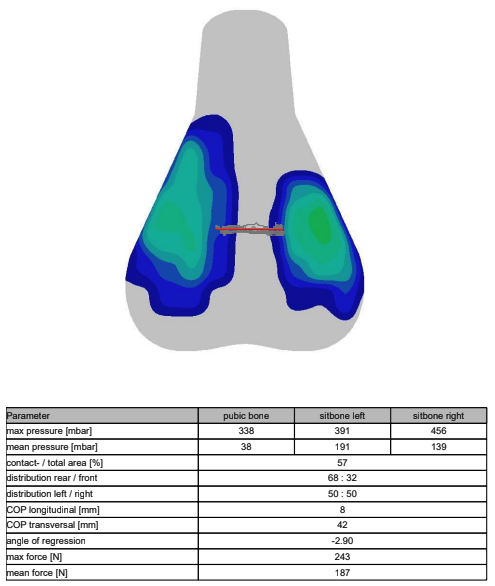 A visual output of saddle pressure mapping