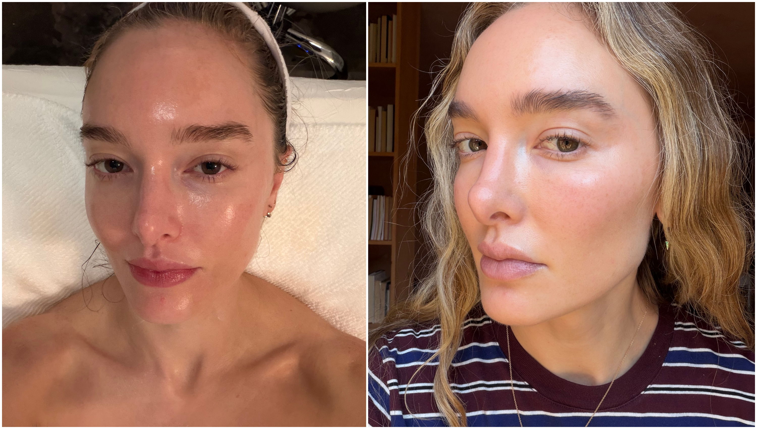 two photos of the same woman, one of a close-up on a facial table with glowy skin, and the next with wavy hair and glowing, flawless skin