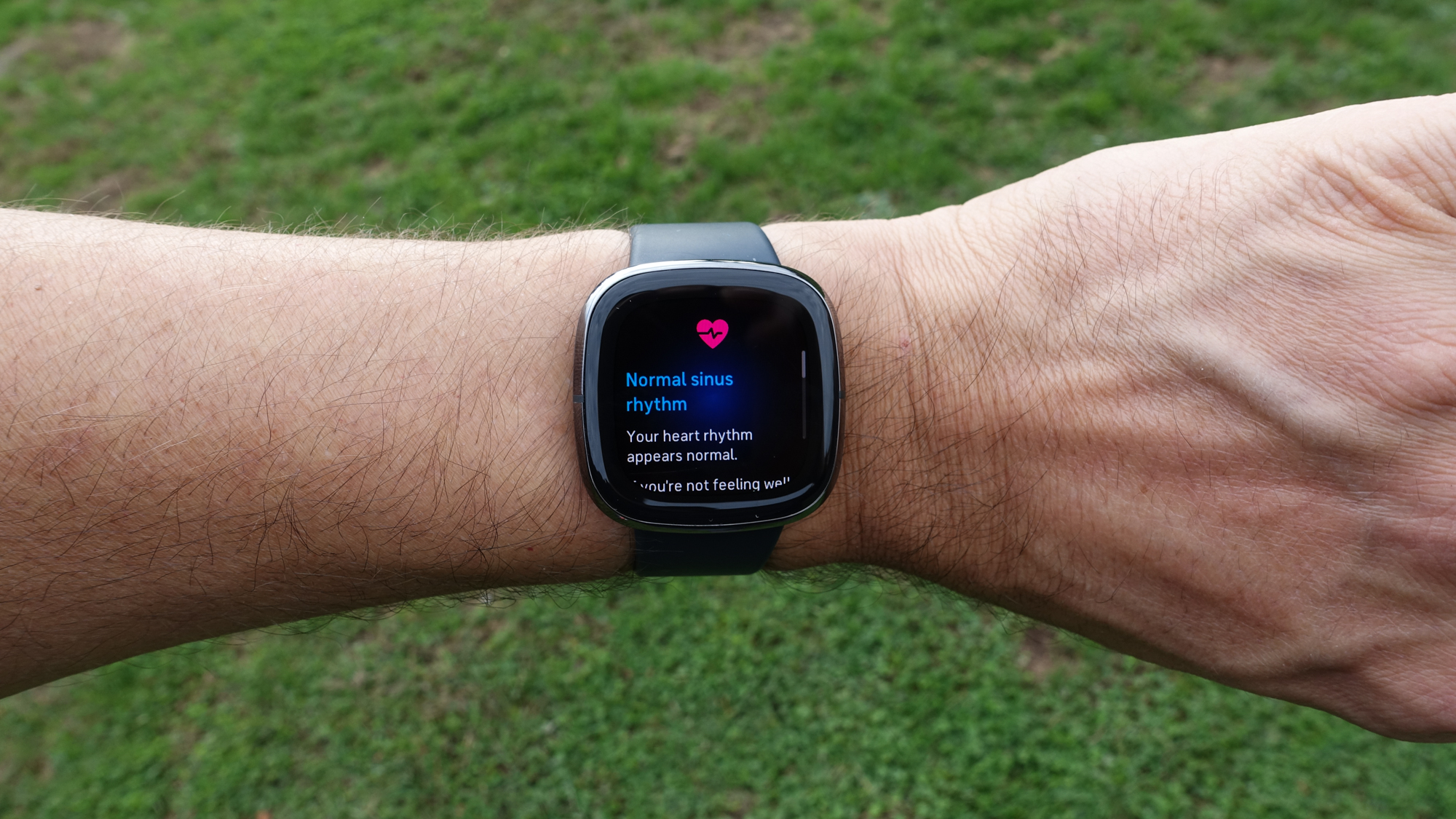 Your Fitbit Sense May Need To Be Replaced Here s Why Tom s Guide